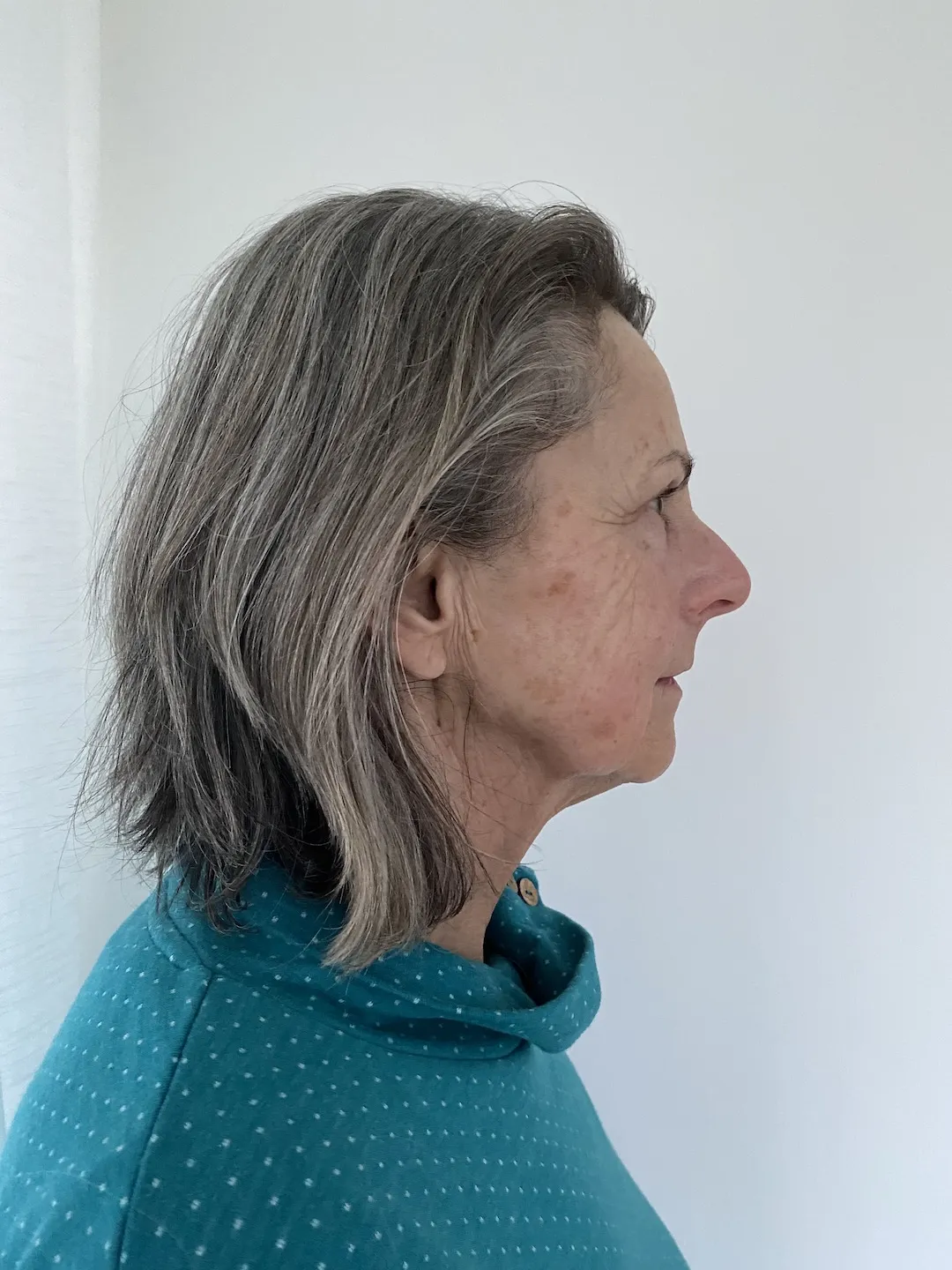 After a Zone Face Lift
